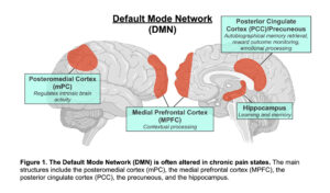 A figure of the brain's default mode network (DMN), with various ssections of the brains highlighted in the figure.