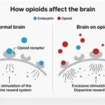 A diagram of The Human Body’s Opioid System: Synthesis, Receptor Binding, and the Roots of Opioid Addiction. The image shows two side with ine side of the normal brain and the other of the brains on opioids.