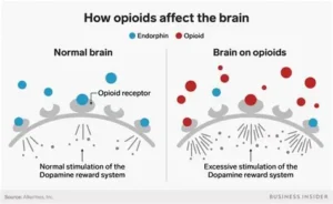 A diagram of The Human Body’s Opioid System: Synthesis, Receptor Binding, and the Roots of Opioid Addiction. The image shows two side with ine side of the normal brain and the other of the brains on opioids.