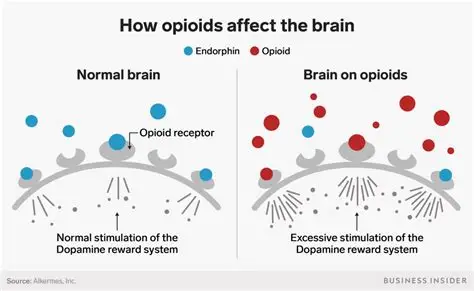 A diagram of The Human Body’s Opioid System: Synthesis, Receptor Binding, and the Roots of Opioid Addiction. The image shows two side with ine side of the normal brain and the other of the brains on opioids.